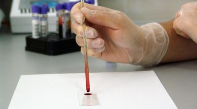 Clinical Lipid Sampling